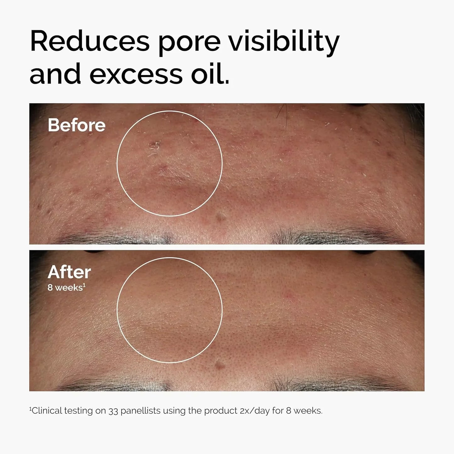 10% Niacinamide + 1% Zinc Facial Serum