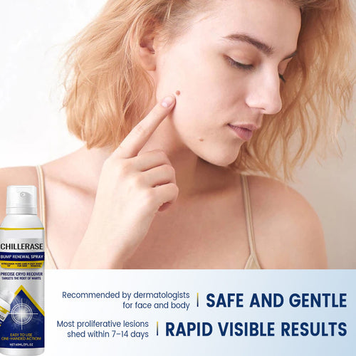 Chillerase Care Cooling Spray